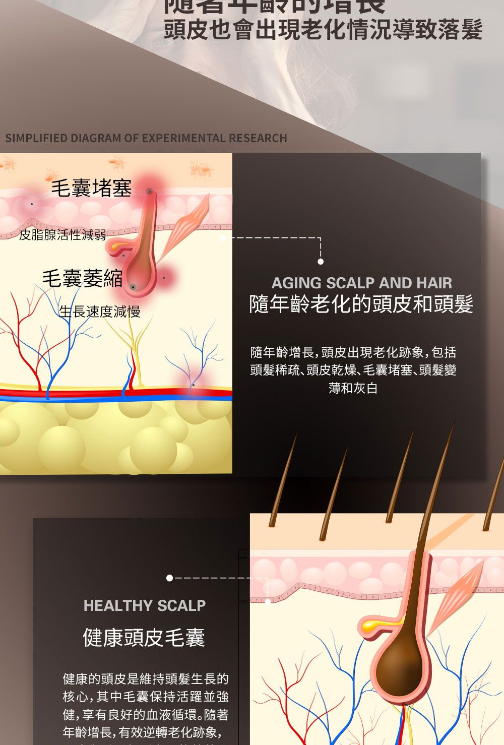 頭皮也會出現老化情況導致落髮SIMPLIFIED DIAGRAM OF EXPERIMENTAL RESEARCH毛囊堵塞皮脂腺活性減弱毛囊AGING SCALP AND HAIR生長速度減慢隨年齡老化的頭皮和頭髮HEALTHY SCALP健康頭皮毛囊健康的頭皮是維持頭髮生長的核心,其中毛囊保持活躍並強健,享有良好的血液循環。隨著年齡增長,有效逆轉老化跡象,隨年齡增長,頭皮出現老化跡象,包括頭髮稀疏頭皮乾燥毛囊堵塞、頭髮變薄和灰白