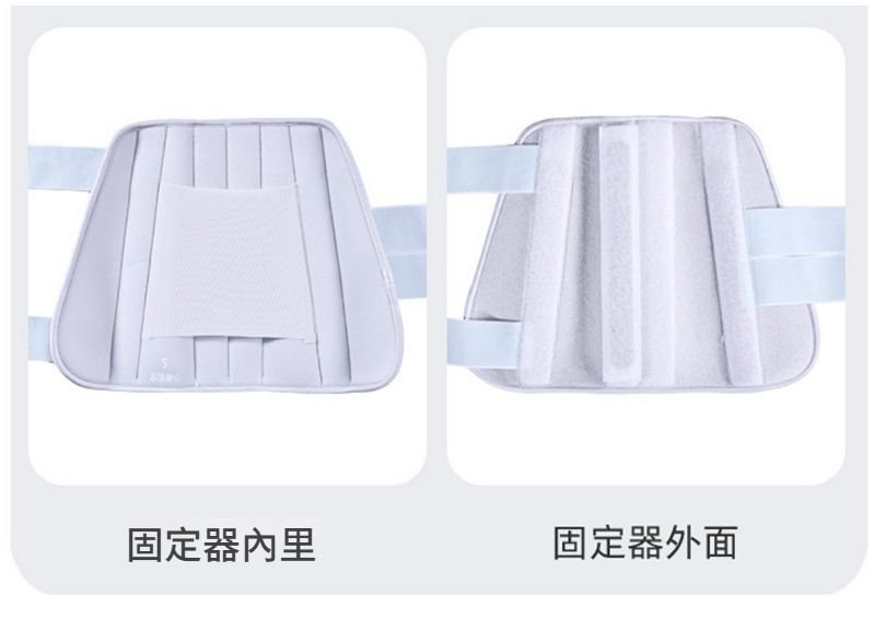 固定器內里固定器外面