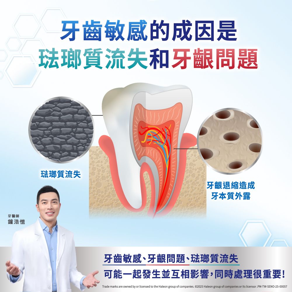 牙醫師鐘浩愷牙齒敏感的成因是琺瑯質流失和牙齦問題琺瑯質流失牙齦退縮造成牙本質外露牙齒敏感、牙齦問題、琺瑯質流失可能一起發生並互相影響,同時處理很重要Trade marks are owned by or licensed to the Haleon group of companies. ©2025 Haleon group of companies or its licensor.PM-TW-SENO-25-00057