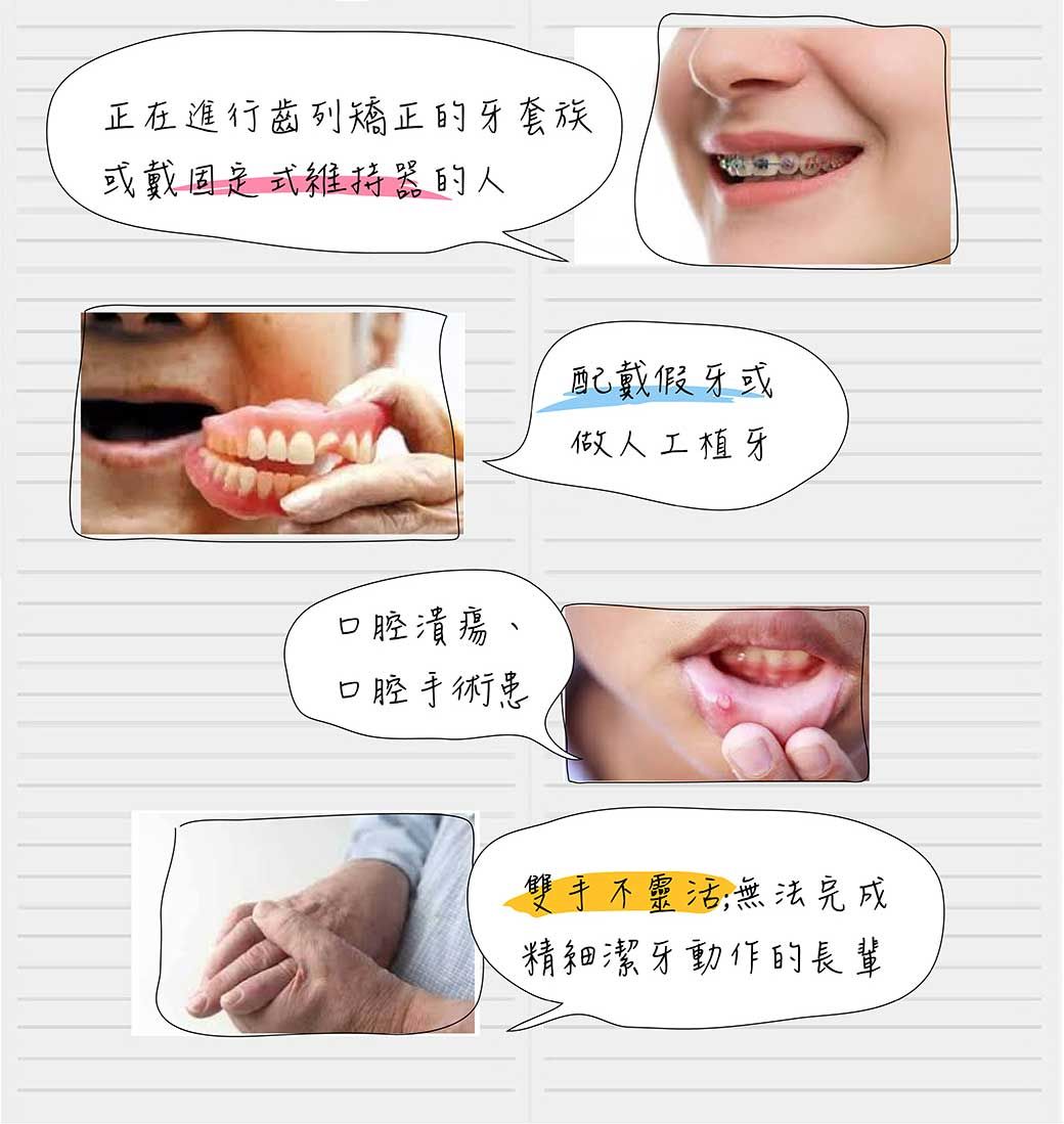正在進行齒列矯正的牙套族或戴固定式維持器的人口腔潰瘍口腔手術患配戴假牙或做人工植牙雙手不靈活無法完成精細潔牙動作的長輩