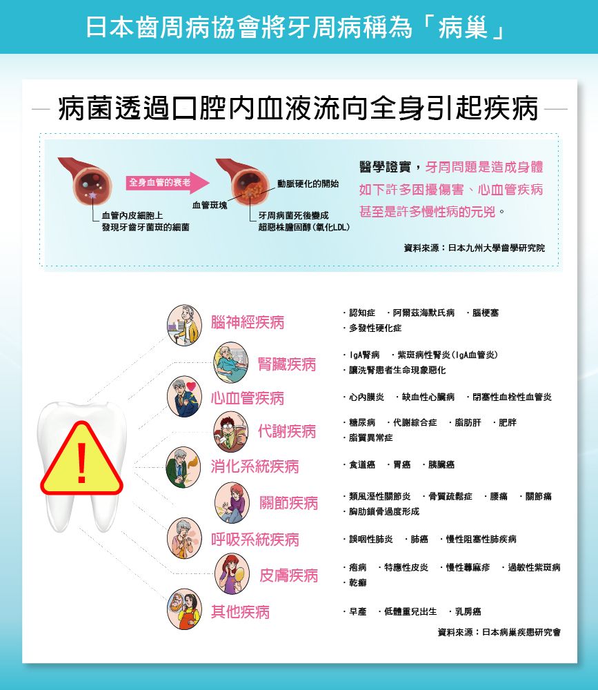 日本齒周病協會將牙周病稱為「病巢」病菌透過口腔内血液流向全身引起疾病全身血管的衰老動脈硬化的開始血管斑塊血管細胞上發現牙齒牙菌斑的細菌牙周病菌死後變成超惡株膽固醇氧化LDL)醫學證實牙周問題是造成身體如下許多困擾傷害心血管疾病甚至是許多慢性病的元兇。資料來源:日本九州大學齒學研究院腦神經疾病腎臟疾病心血管疾病代謝疾病消化系統疾病認知症 阿爾茲海默氏病 腦梗塞多發性硬化症 紫斑病性(血管炎)讓洗腎患者生命現象惡化心內膜炎 缺血性心臟病 閉塞性血栓性血管炎糖尿病 代謝綜合症 脂肪肝 肥胖脂質異常症食道癌 ·胃癌 胰臟癌關節疾病·類風溼性關節炎 骨質疏鬆症 腰痛 關節痛·胸肋鎖骨過度形成呼吸系統疾病誤咽性肺炎 肺癌 ·慢性阻塞性肺疾病皮膚疾病·疱病 ·特應性皮炎 ·慢性蕁麻疹、過敏性紫斑病·乾癬其他疾病·早產,體重兒出生·乳房癌資料來源:日本病巢疾患研究會