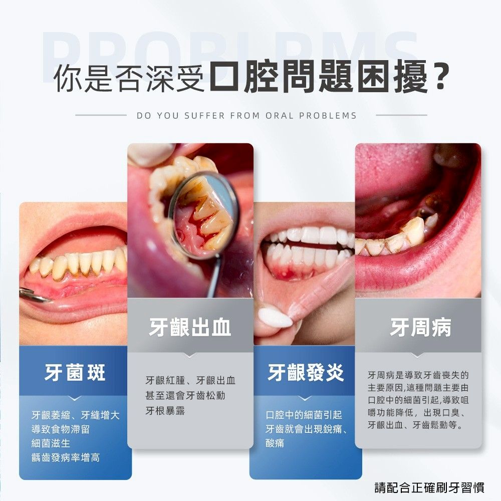 你是否深受口腔問題困擾?DO YOU SUFFER FROM ORAL PROBLEMS牙齦出血牙菌斑牙齦牙縫增大牙齦紅腫、牙齦出血甚至還會牙齒松動牙根暴露牙齦發炎導致食物滯留細菌滋生口腔中的細菌引起牙齒就會出現銳痛、酸痛齲齒發病率增加牙 周 病 牙周病是導致牙齒喪失的主要原因,這種問題主要由口腔中的細菌引起,導致咀嚼功能降低,出現口臭、牙齦出血、牙齒鬆動等。請配合正確刷牙習慣