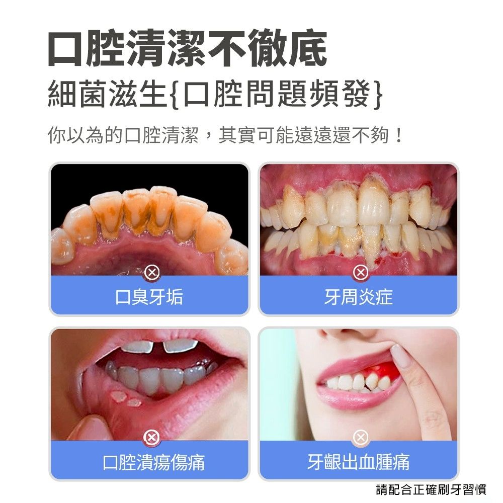 口腔清潔不徹底細菌滋生口腔問題頻發}你以為的口腔清潔,其實可能遠遠還不夠!口臭牙垢牙周炎症口腔潰瘍傷痛牙齦出血腫痛請配合正確刷牙習慣
