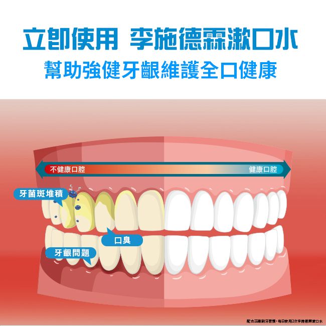 立使用 施德霖水幫助強健牙齦維護全口健康不健康口腔牙菌斑堆積口臭牙齦問題健康口腔配合正確刷牙習慣,每日使用2李漱口水