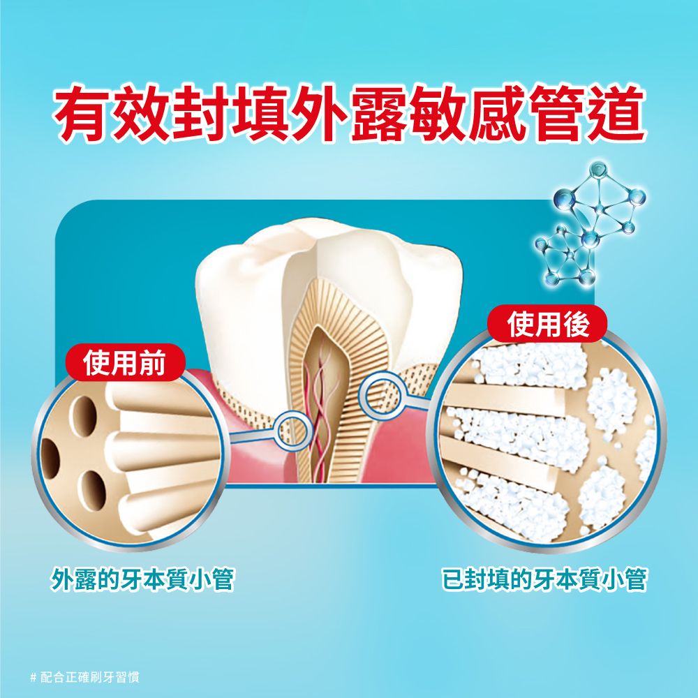 高露潔 抗敏專家 - 牙齦護理牙膏110gx3