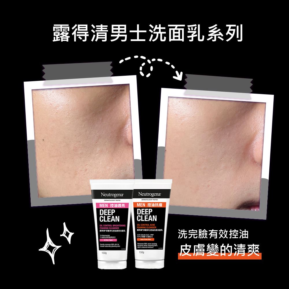 露得清男士洗面乳系列NeutrogenaMEN 控油透亮DEEPCLEAN CONTR BRIGHTENINGFOAMING NeutrogenaMEN 控油抗痘DEEPCLEANOL CONTROL FOAMING CLEANSER  removes   150g洗完臉有效控油皮膚變的清爽