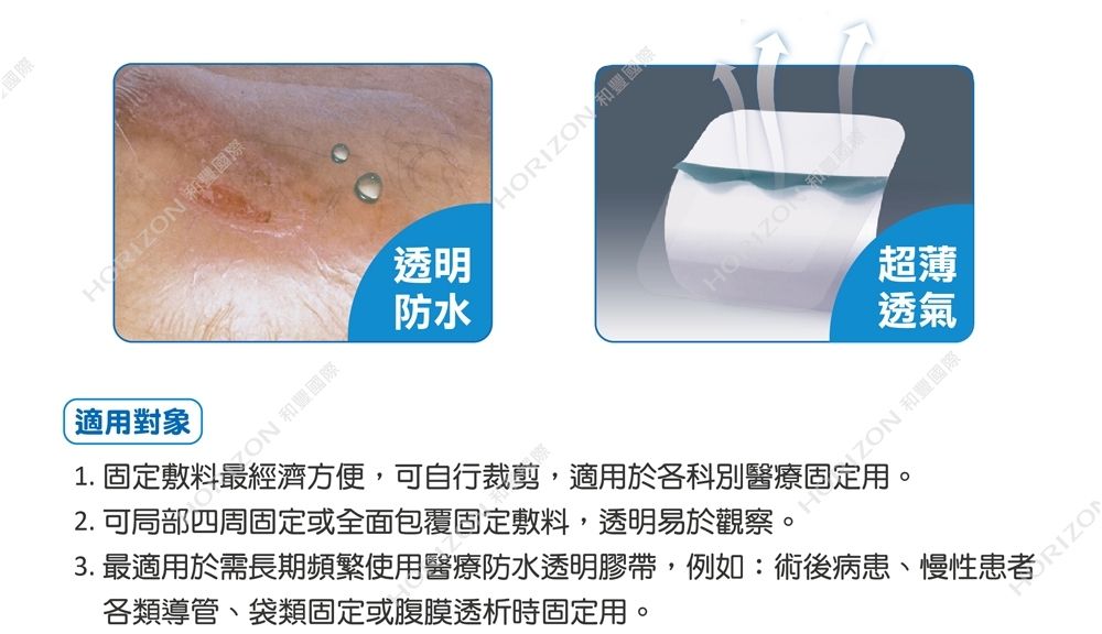 國際 透明防水HORI適對象ON 和豐國際1.固定敷料最經濟方便,可自行裁剪,適用於各科別醫療用N2. 可局部四周固定或全面包覆固定敷料,透明易於觀察超薄透氣ZON 和豐國際。3. 最適用於需長期頻繁使用醫療防水透明膠帶,例如:術後病患、慢性ZO各類導管、袋類固定或腹膜透析時固定用。