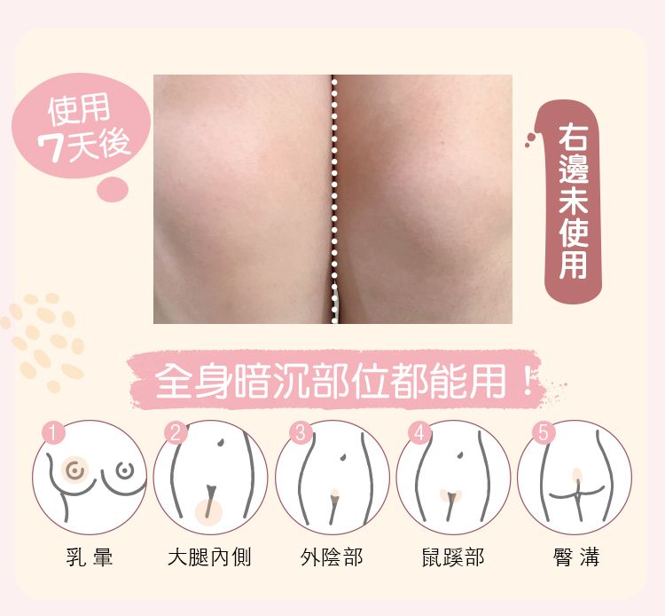 使用7天後使用全身暗沉部位都能用!1235乳暈 大腿內側外陰部 鼠蹊部臀溝
