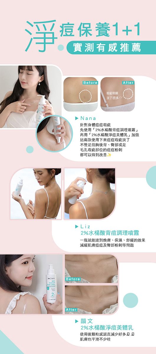 淨痘保養1+1實測有感推薦BeforeAfter瑕疵淡了很多!!! Nana針對身體瑕疵先使用「2%水楊酸背痘調理噴霧再用「2%水楊酸淨痘美體乳」加強這兩款使用下來痘痘瑕疵淡了不管是前胸後背、臀部或是毛孔瑕疵部位的痘痘都可以得到▶Liz2%水楊酸背痘調理噴霧一瓶就能達到煥膚、保濕、舒緩的效果減緩肌膚痘痘及臀部粉刺等問題BeforeAfter▶ 韻文2%水楊酸淨痘美體乳使用後認真減少好多肌膚也平滑不少哇