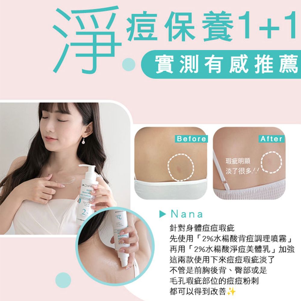 St.Clare 聖克萊爾 2%水楊酸背痘調理噴霧100ml(美背噴霧/升級版)