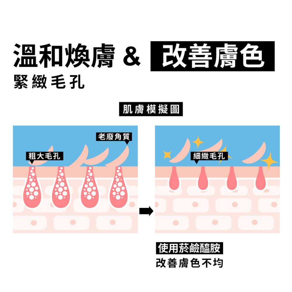 溫和煥膚& 改善膚色緊緻毛孔肌膚模擬圖老廢角質粗大毛孔| 細緻毛孔|使用菸鹼醯胺|改善膚色不均