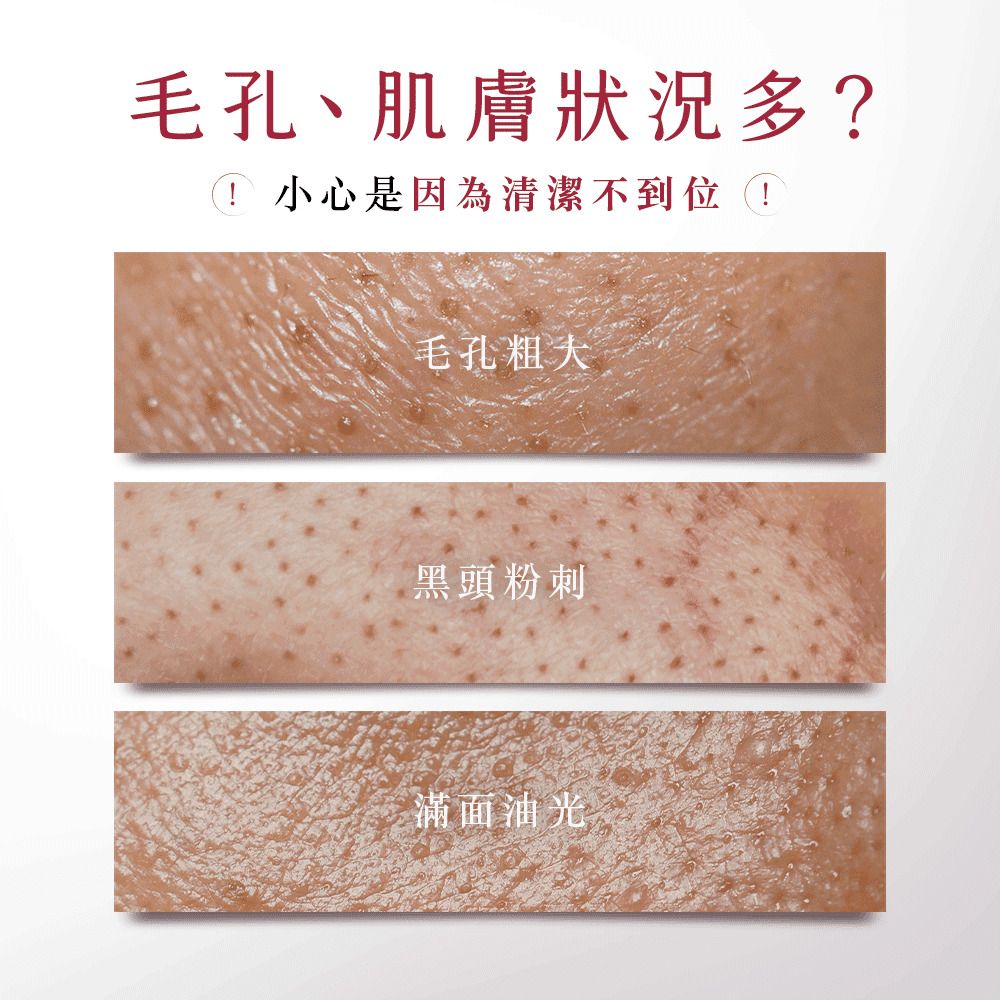 毛孔、肌膚狀況多? 小心是因為清潔不到位毛孔粗大黑頭粉刺滿面油光