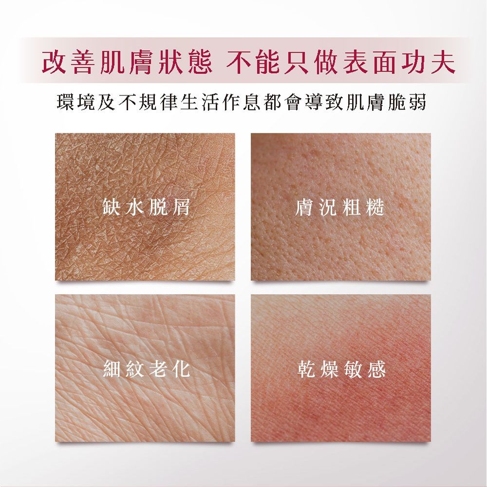 改善肌狀態 不能只做表面功夫環境及不規律生活作息都會導致肌膚脆弱缺水脱屑膚況粗糙細紋老化乾燥敏感