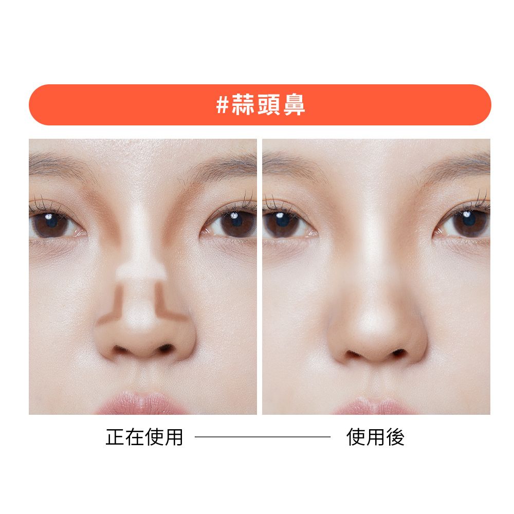 #蒜頭鼻正在使用使用後