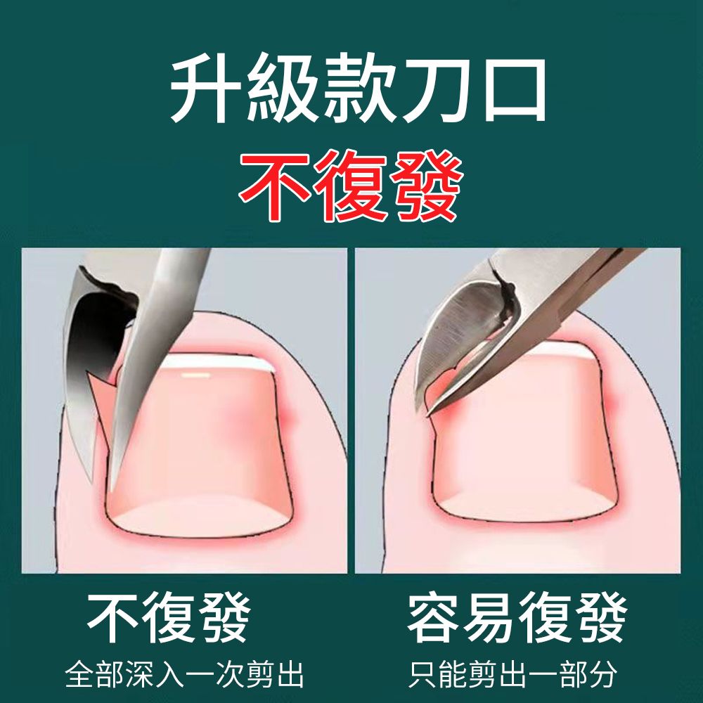 ElAiNE 德國精工不鏽鋼甲溝鉗 凍甲指甲剪 鷹嘴鉗修腳套裝 嵌甲死皮剪 甲溝炎指甲剪 銼腳板 16件組 黑色