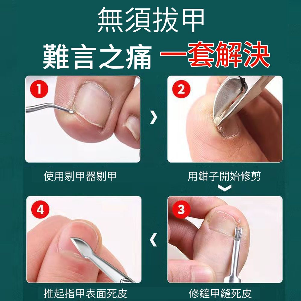 ElAiNE 德國精工不鏽鋼甲溝鉗 凍甲指甲剪 鷹嘴鉗修腳套裝 嵌甲死皮剪 甲溝炎指甲剪 銼腳板 16件組 黑色
