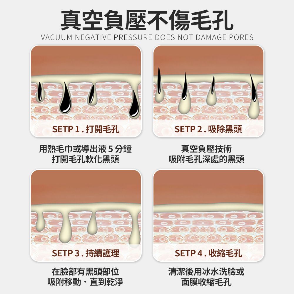  ZHE 醫療級微晶吸頭 粉刺機 真空負壓 粉刺夾 深層清潔去黑頭粉刺