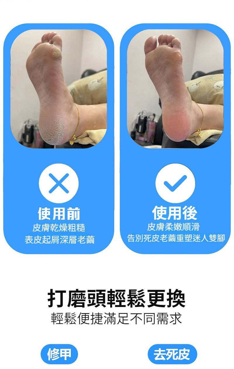 使用前皮膚乾燥粗糙使用後皮膚柔嫩順滑表皮起深層老繭告別死皮老繭重塑迷人雙腳打磨頭輕鬆更換輕鬆便捷滿足不同需求修甲去死皮