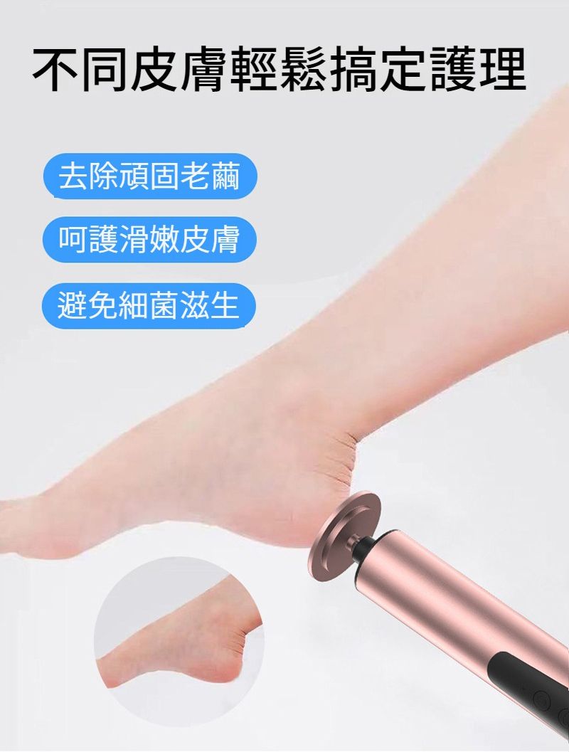 不同皮膚輕鬆搞定護理去除頑固老繭呵護滑嫩皮膚避免細菌滋生