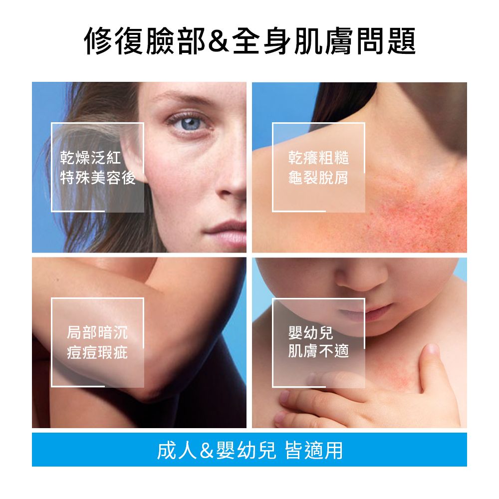 修復臉部&全身肌膚問題乾燥泛紅 乾癢粗糙特殊美容後龜裂脫屑局部暗沉痘痘瑕疵幼兒肌膚不適成人&嬰幼兒 皆適用