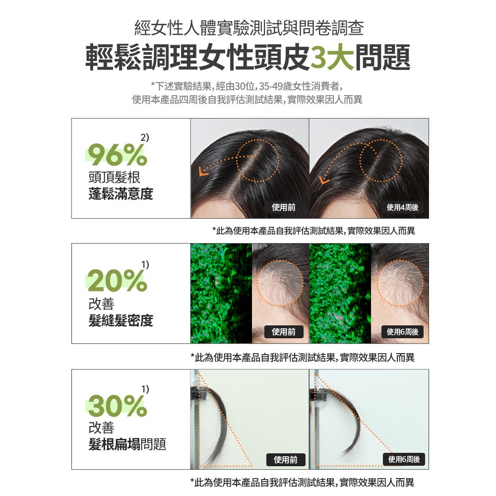 經女性人體實驗測試與問卷調查輕鬆調理女性頭皮3大問題*下述實驗結果,經由30位,35-49歲女性消費者,使用本產品四周後自我評估測試結果,實際效果因人而異2)96%頭頂髮根蓬鬆滿意度1)20%改善使用前使用4周後*此為使用本產品自我評估測試結果,實際效果因人而異度1)30%改善髮根扁塌問題使用前使用6周後*此為使用本產品自我評估測試結果,實際效果因人而異使用前使用6周後*此為使用本產品自我評估測試結果,實際效果因人而異