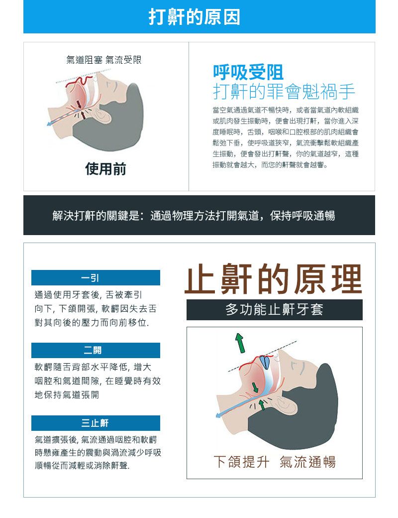 道阻塞 氣流受限使用前打的原因呼吸受阻打鼾的罪會魁禍當空氣通過氣道不暢快時,或者當氣道內軟組織或肌肉發生振動時,便會出現打鼾,當你進入深度睡眠時,舌頭,咽喉和口腔根部的肌肉組織會鬆弛下垂,使呼吸道狹窄,氣流衝擊鬆軟組織產生振動,便會發出打鼾聲,你的氣道越窄,這種振動就會越大,而您的鼾聲就會越響。解決打鼾的關鍵是:通過物理方法打開氣道,保持呼吸通暢一引通過使用牙套後,舌被牽引向下,下頜開張,軟齶因失去舌對其向後的壓力而向前移位止鼾的原理多功能止鼾牙套二開軟齶隨舌背部水平降低,增大咽腔和氣道間隙,在睡覺時有效地保持氣道張開三止鼾氣道擴張後,氣流通過咽腔和軟齶時懸雍產生的震動與渦流減少呼吸順暢從而減輕或消除鼾聲下頜提升氣流通暢