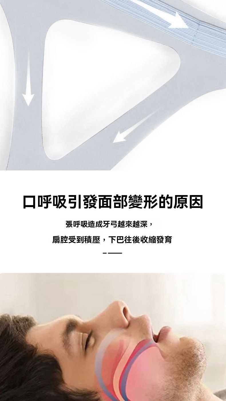 口呼吸引發面部變形的原因張呼吸造成牙弓越來越深,扇腔受到積壓,下巴往後收縮發育