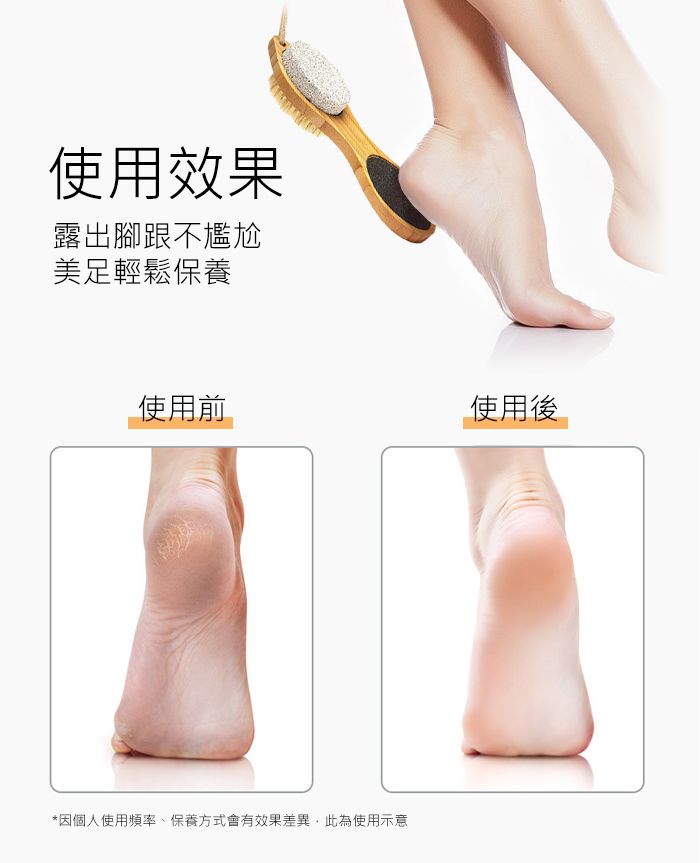 使用效果露出腳跟不尷尬美足輕鬆保養使用前使用後*因個人使用頻率、保養方式會有效果差異,此為使用示意
