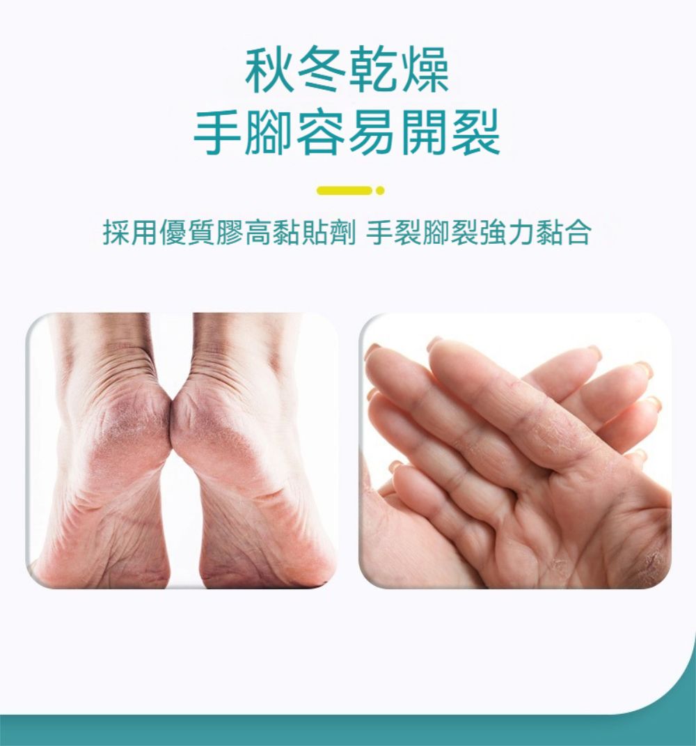 秋冬乾燥手腳容易開裂採用優質膠高黏貼劑 手裂腳裂強力黏合