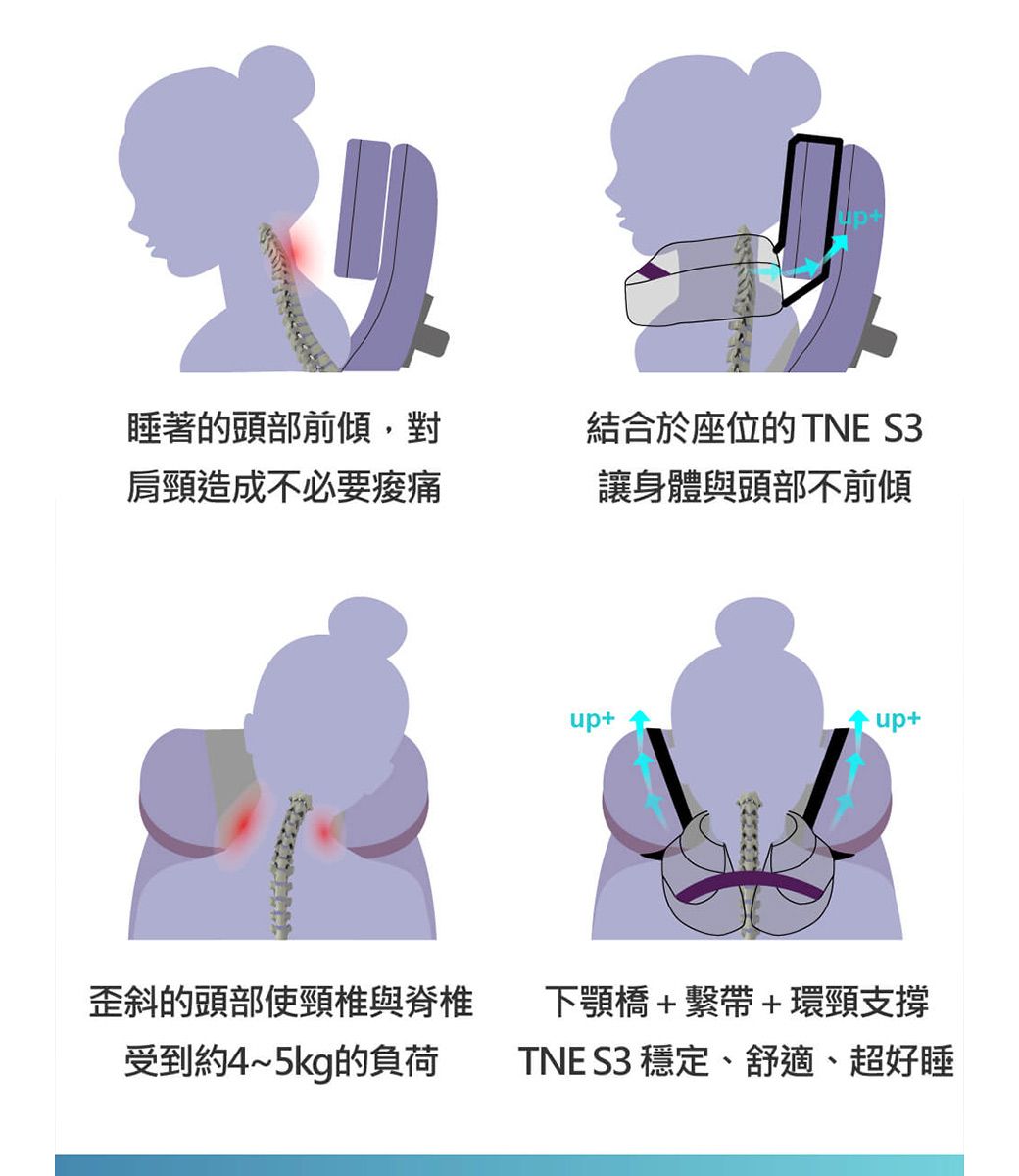 睡著的頭部前傾對肩頸造成不必要痠痛結合於座位的 TNE S3讓身體與頭部不前傾up+up+歪斜的頭部使頸椎與脊椎受到約4~5kg的負荷下顎橋+繫帶+環頸支撐TNE S3 穩定、舒適、超好睡