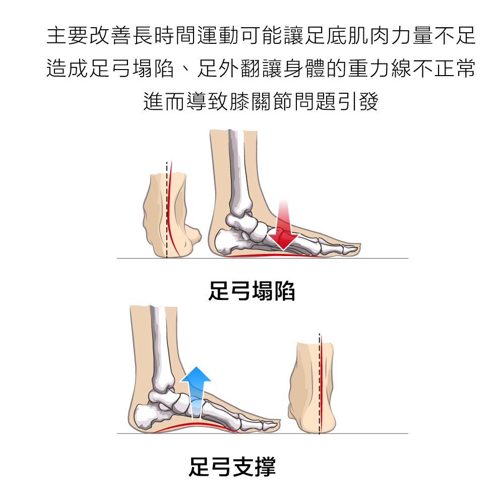 主要改善長時間運動可能讓足底肌肉力量不足造成足弓塌陷、足外翻讓身體的重力線不正常進而導致膝關節問題引發足弓塌陷足弓支撑