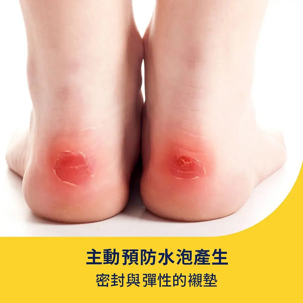 主動預防水泡產生密封與彈性的襯墊