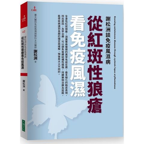 謝松洲談免疫風濕病：從紅斑性狼瘡看免疫風濕