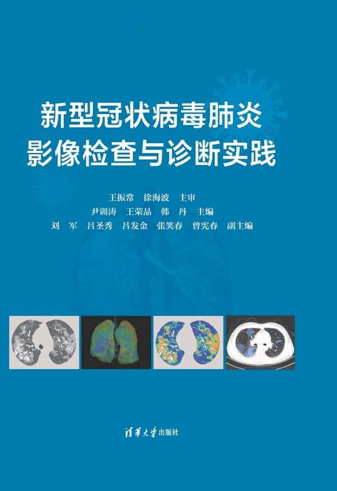 新型冠状病毒肺炎影像检查与诊断实践(Kobo/電子書)