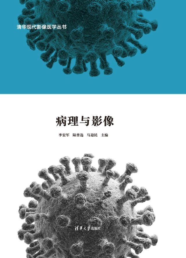  冠状病毒家族肺炎病理与影像(Kobo/電子書)