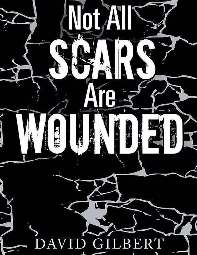  Not All Scars Are Wounded(Kobo/電子書)