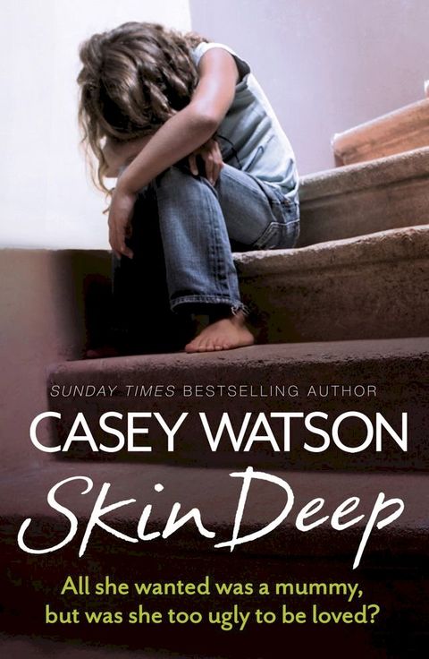 Skin Deep: All She Wanted Was a Mummy, But Was She Too Ugly to Be Loved?(Kobo/電子書)