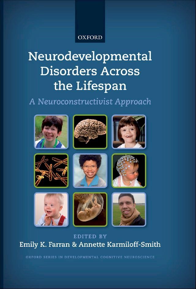  Neurodevelopmental Disorders Across the Lifespan(Kobo/電子書)