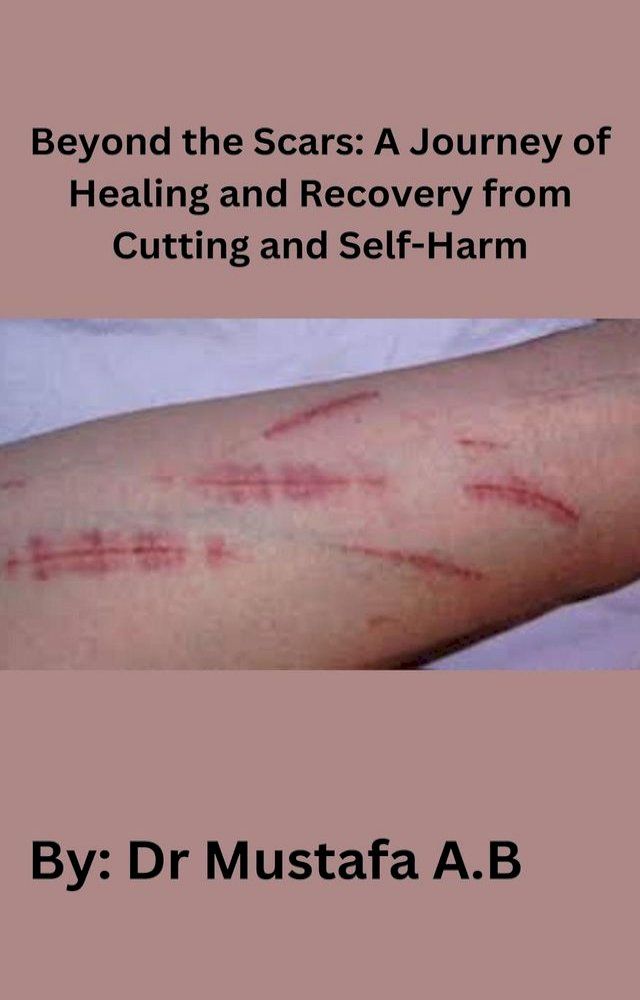  Beyond the Scars: A Journey of Healing and Recovery from Cutting and Self-Harm(Kobo/電子書)