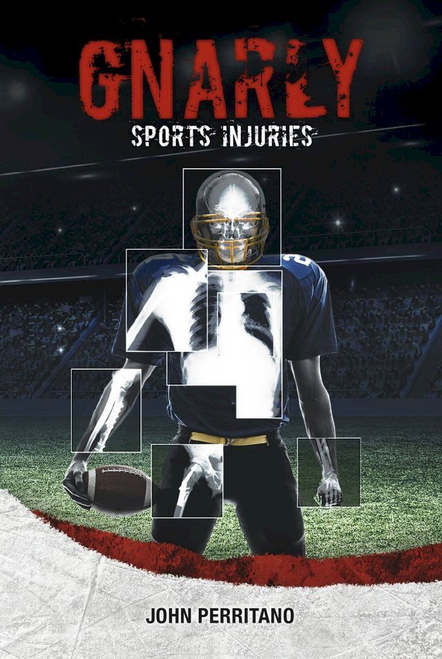  Gnarly Sports Injuries(Kobo/電子書)