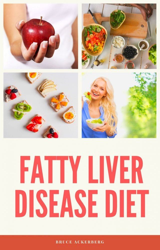  Fatty Liver Disease Diet(Kobo/電子書)