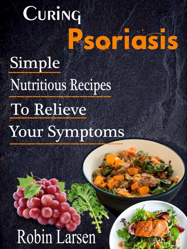  Curing Psoriasis(Kobo/電子書)