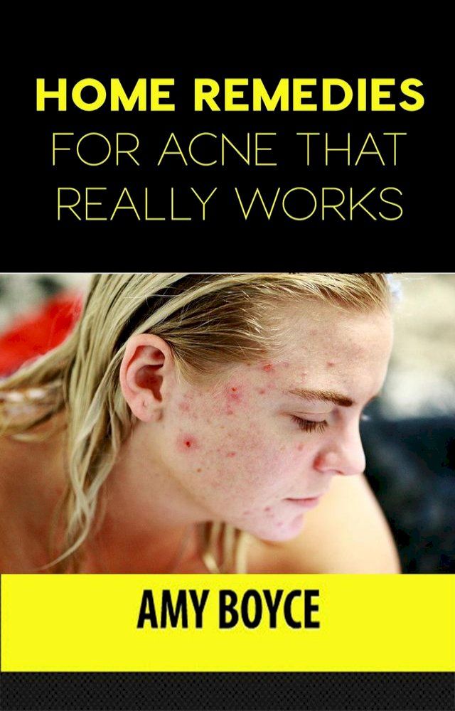  Home Remedies for Acne That Really Works(Kobo/電子書)