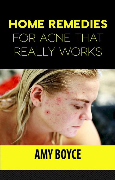 Home Remedies for Acne That Really Works(Kobo/電子書)