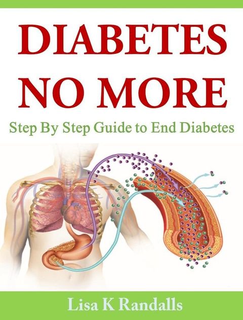 Diabetes No More: Step By Step Guide to End Diabetes(Kobo/電子書)