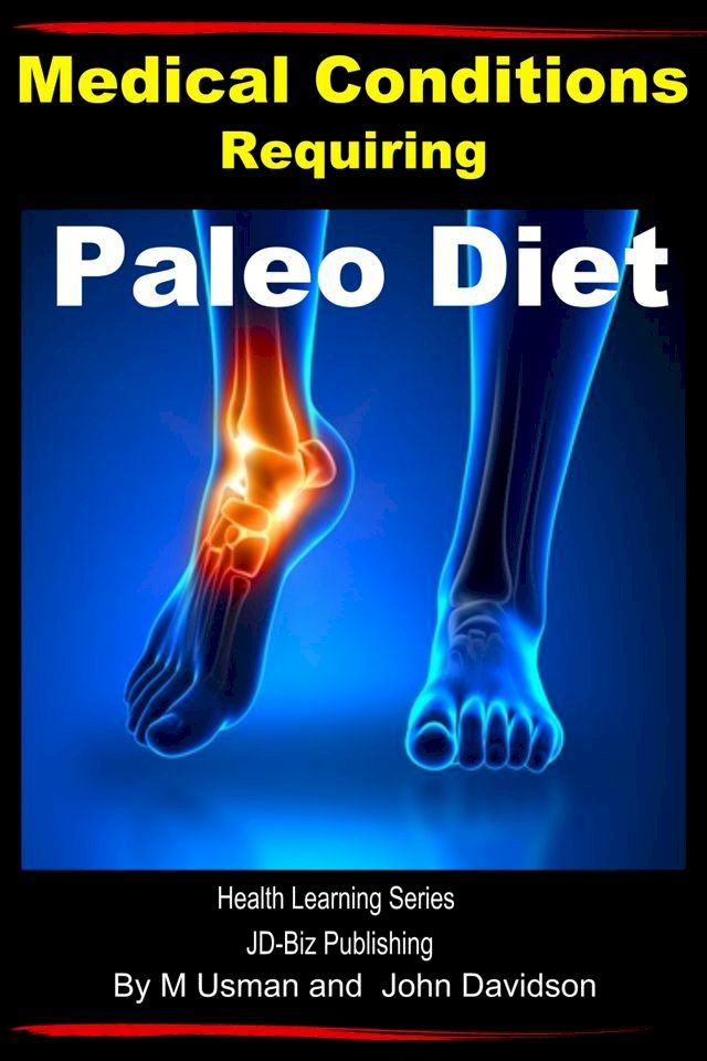  Medical Conditions Requiring Paleo Diet: Health Learning Series(Kobo/電子書)