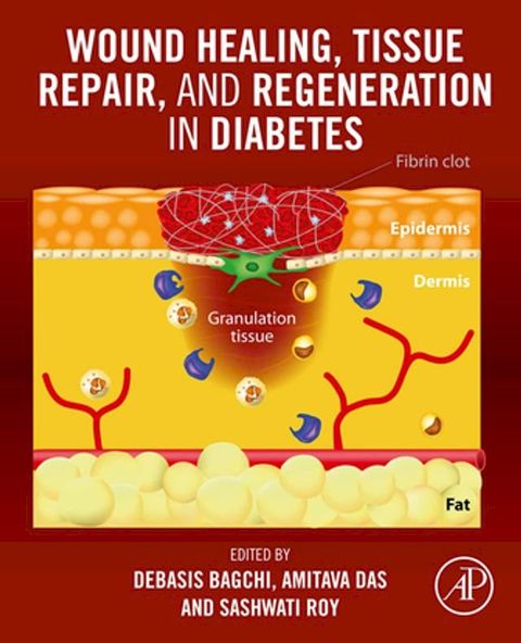 Wound Healing, Tissue Repair, and Regeneration in Diabetes(Kobo/電子書)