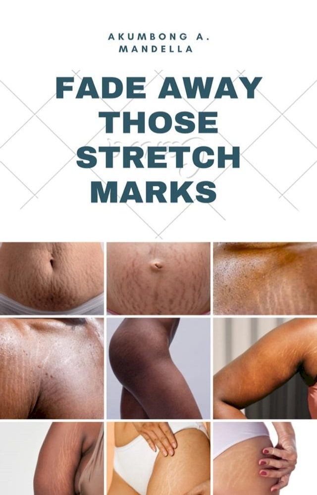  FADE AWAY THOSE STRETCH MARKS(Kobo/電子書)