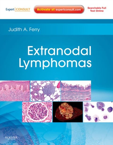 Extranodal Lymphomas E-Book(Kobo/電子書)