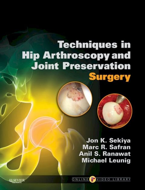 Techniques in Hip Arthroscopy and Joint Preservation E-Book(Kobo/電子書)